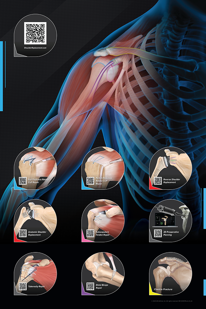 Shoulder Arthroplasty - Patient Outreach Kit